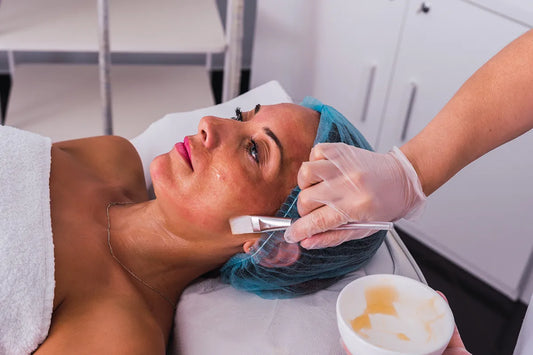 Choosing the Right Chemical Peel for Your Skin Goals