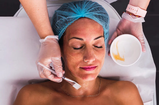 Deep Chemical Peels: Are They Right for You?