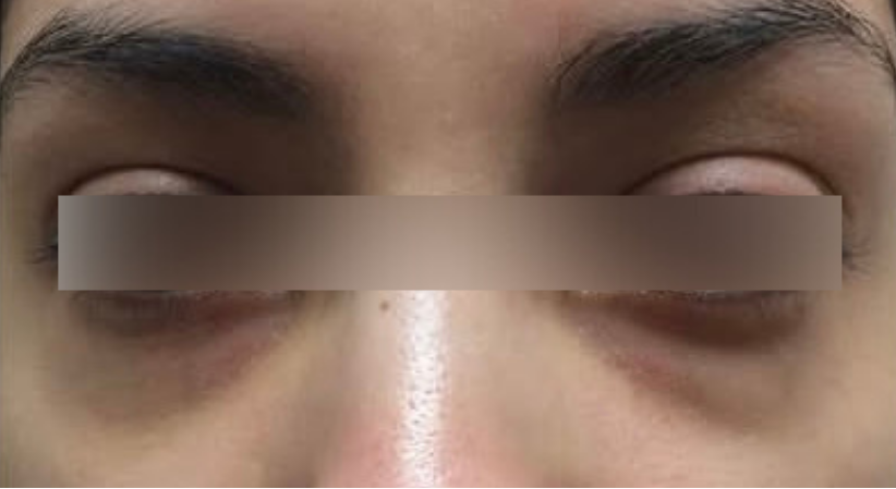 Before image