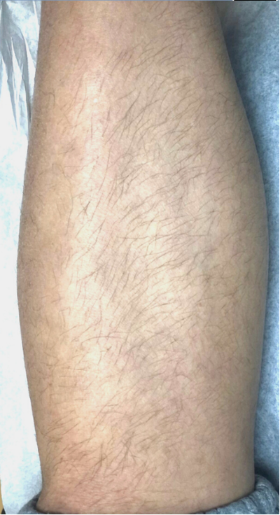 Before image