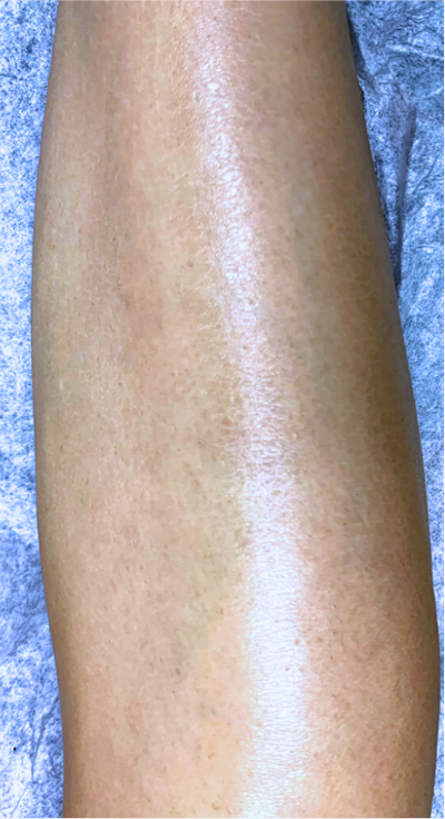 After image